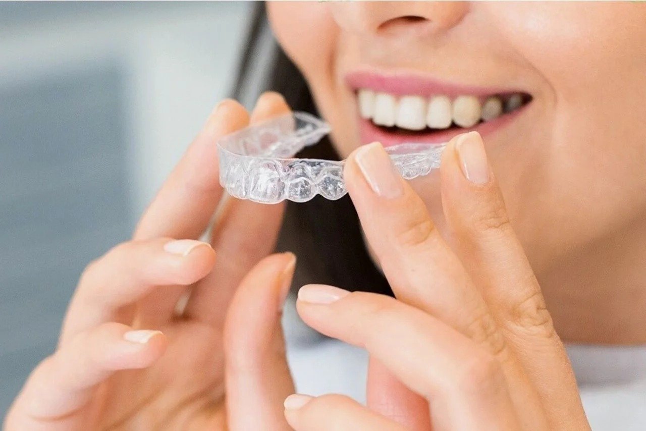 Custom Dental Splints